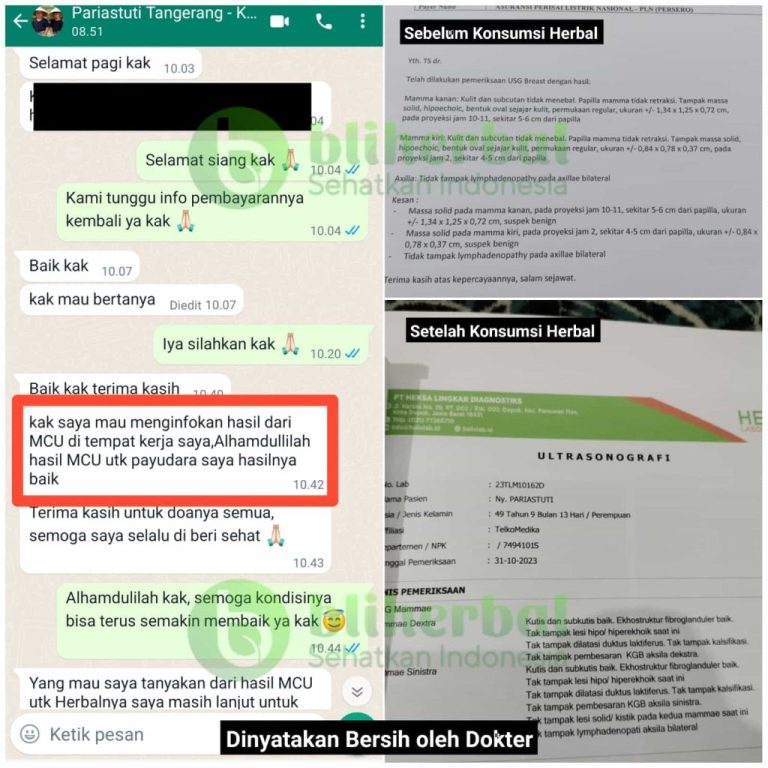 Gambar-WhatsApp-2024-01-15-pukul-12.05.19_b5504dc0666666-1024x1024-1-768x768-1.jpg