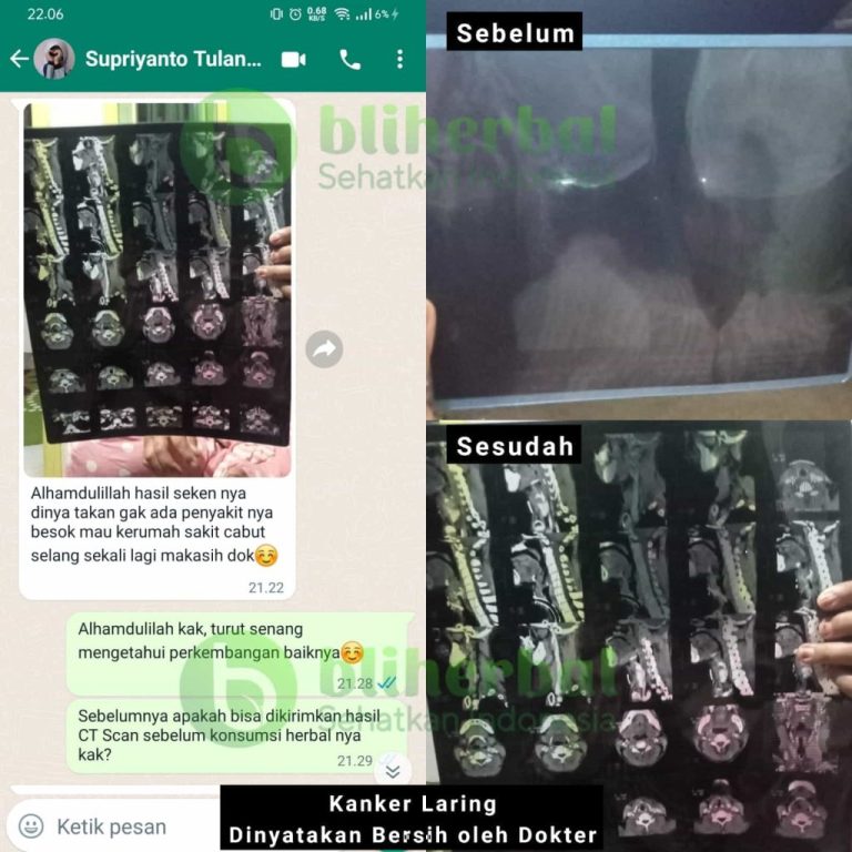 Gambar-WhatsApp-2024-01-15-pukul-12.05.21_8d20f07f5555555-1024x1024-1-768x768-1.jpg